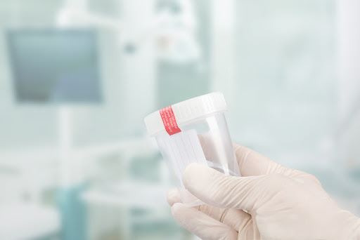 recipient spermogram pentru proba in laborator